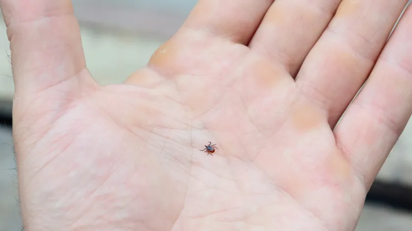 A blacklegged tick in the palm of a man's hand
