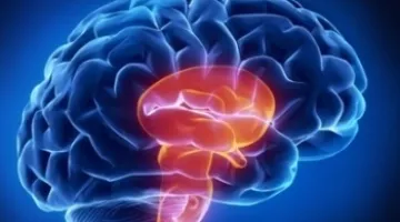 Recognize Signs of Stroke and Take Action
